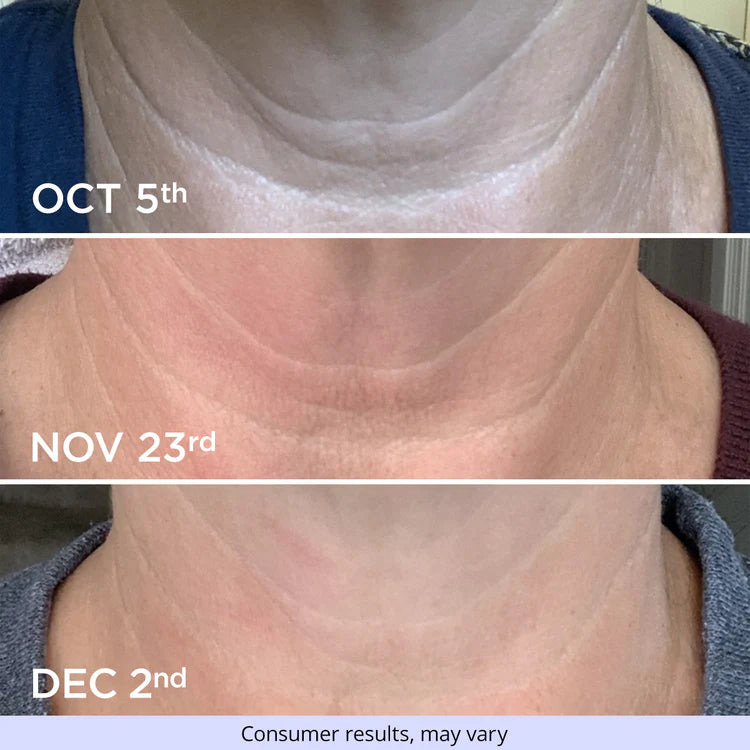 PureNex Epigenetic Neck Renewal Cream